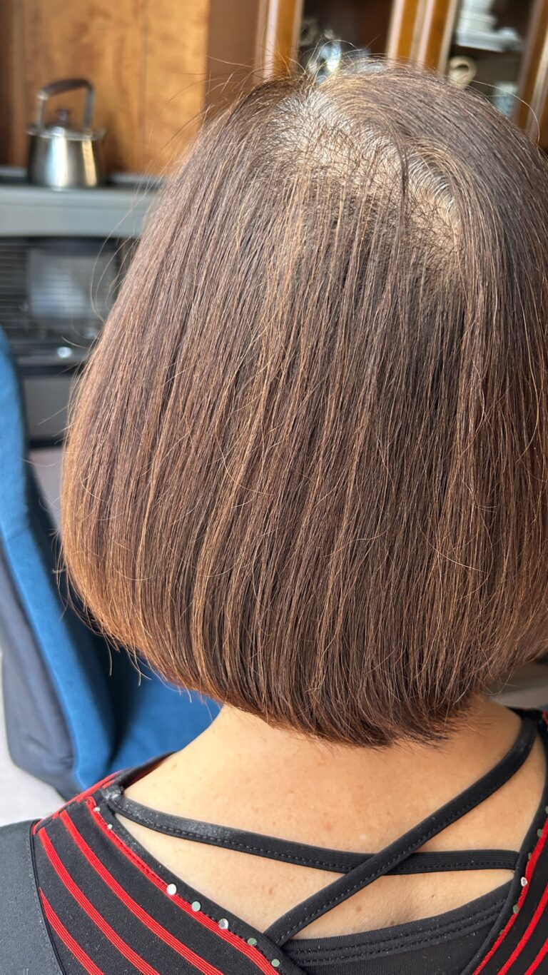 女性の薄毛問題を解決！美容師が教えるケアのコツ